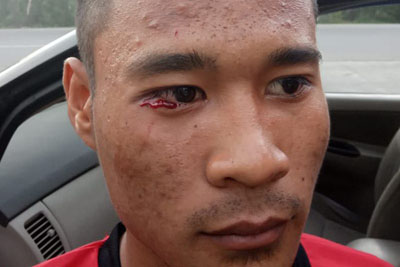 Diduga Aniaya Pesepakbola U-17, Polisi Usut Oknum Wasit 